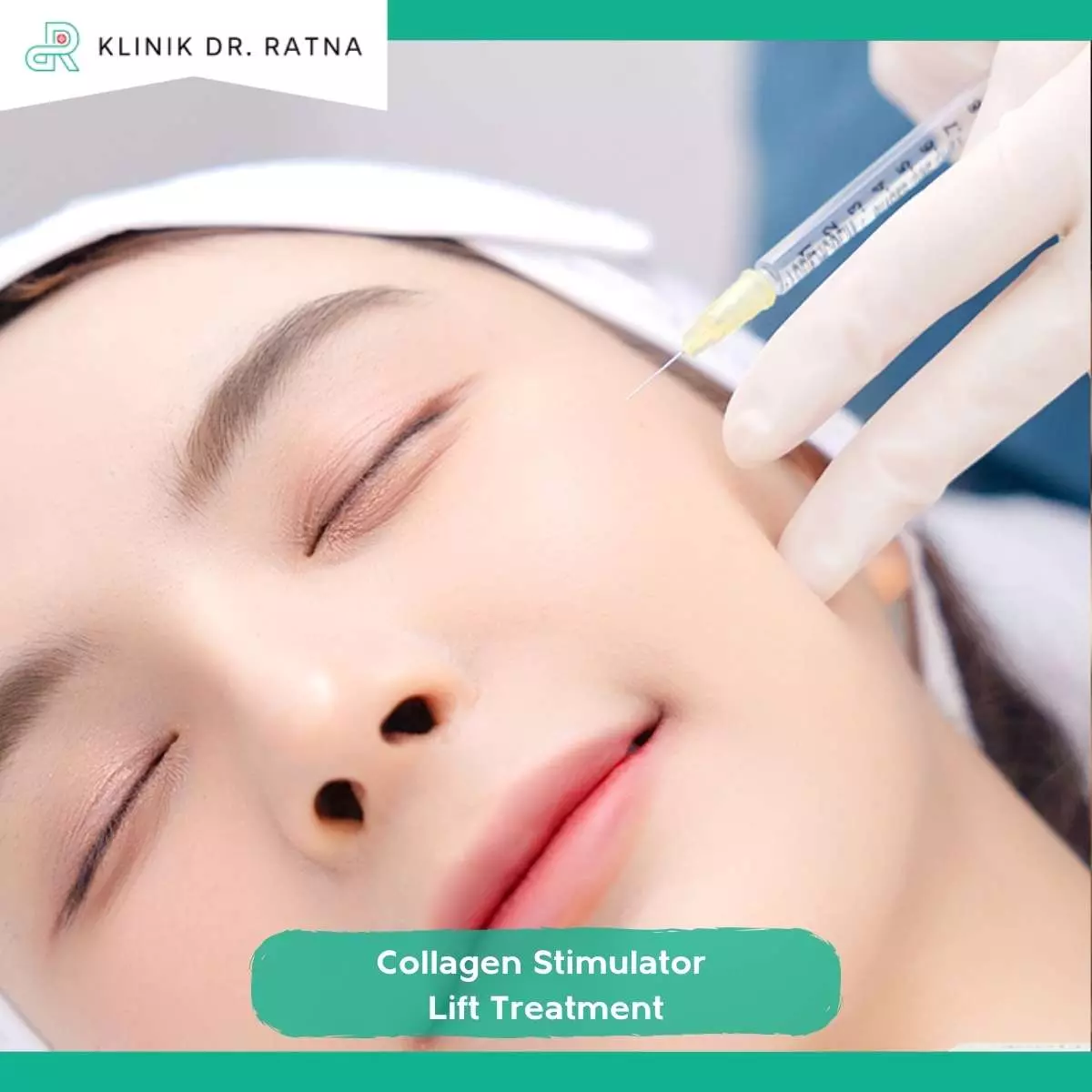 Apa Itu Collagen Stimulator Lift Treatment?