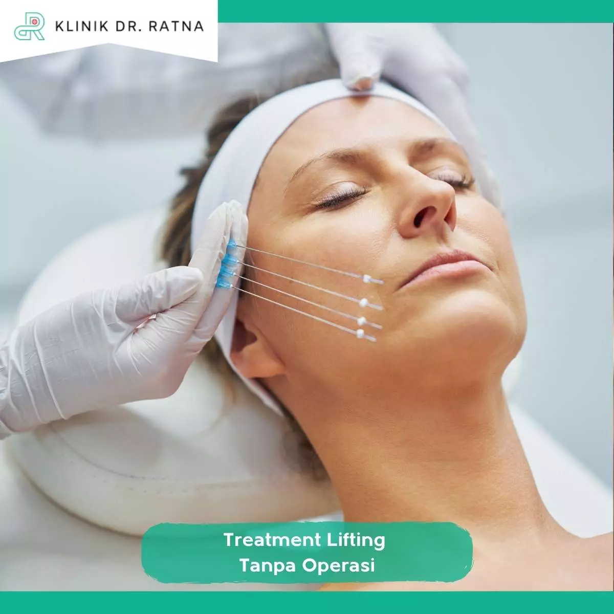 Treatment Lifting Tanpa Operasi yang Populer