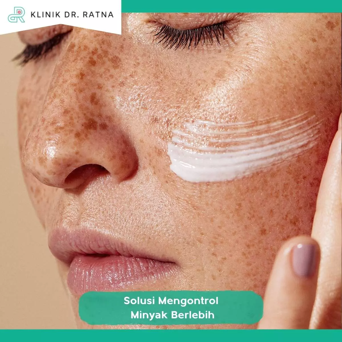 Tips Menjaga Hasil Perawatan Setelah SP Sebum Correction