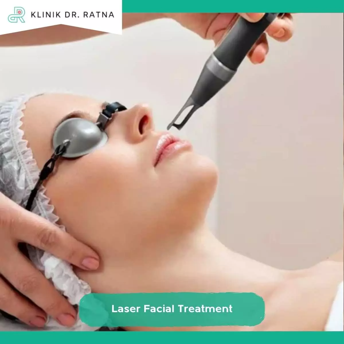 Kekurangan Laser Facial Treatment