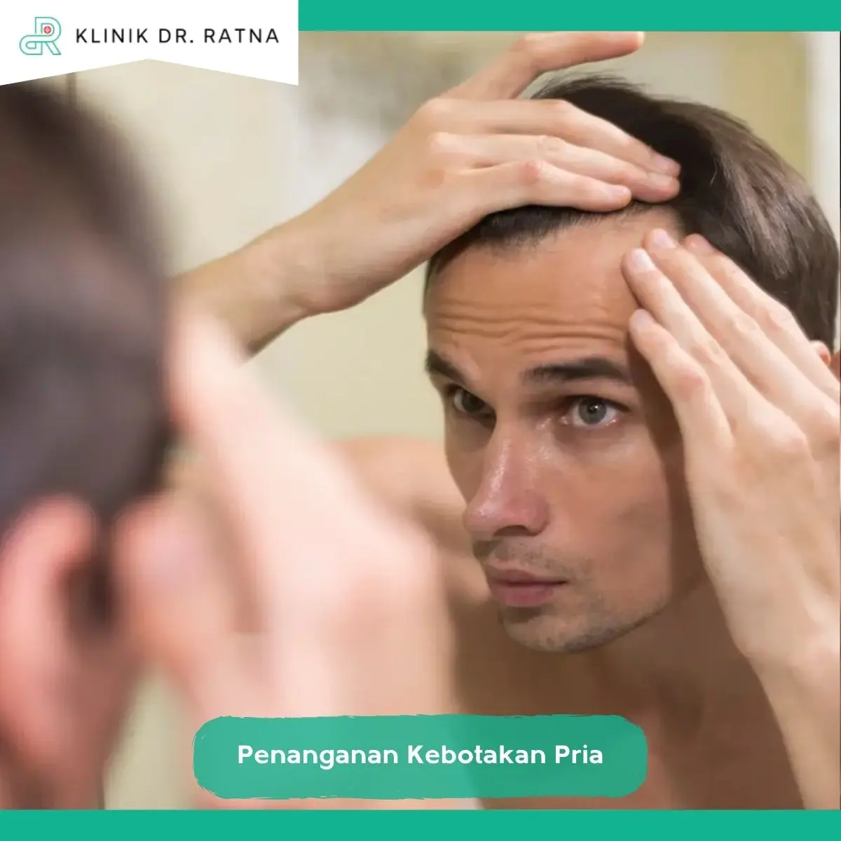 Pilihan Penanganan yang Tepat untuk Kebotakan Pria