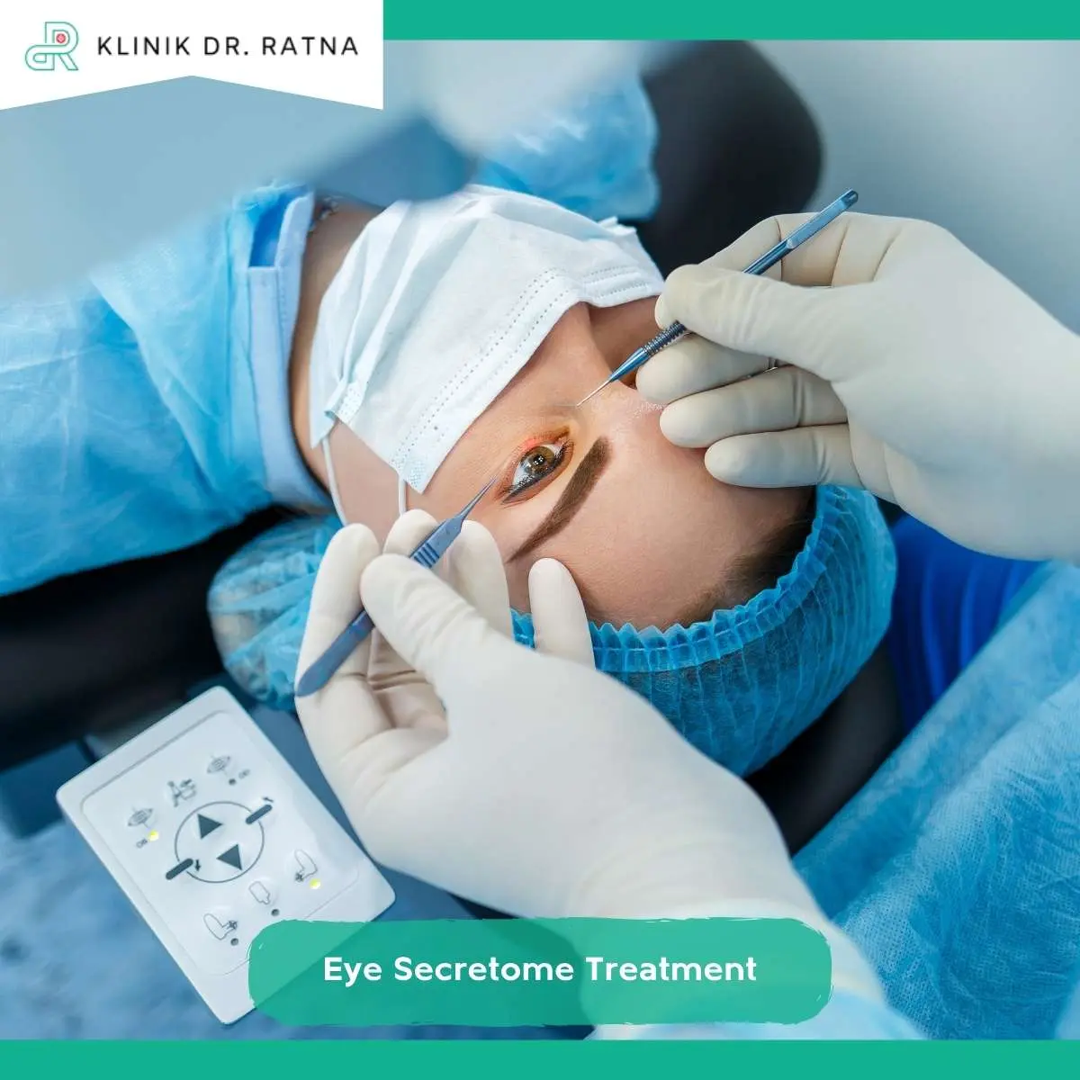 Prosedur Eye Secretome Treatment