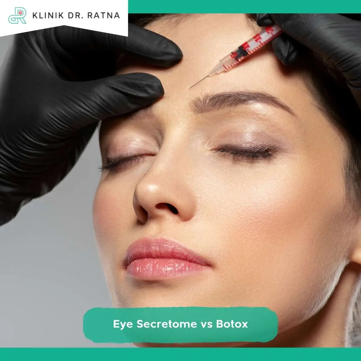 Hasil, Jumlah Sesi, dan Downtime Eye Secretome vs Botox