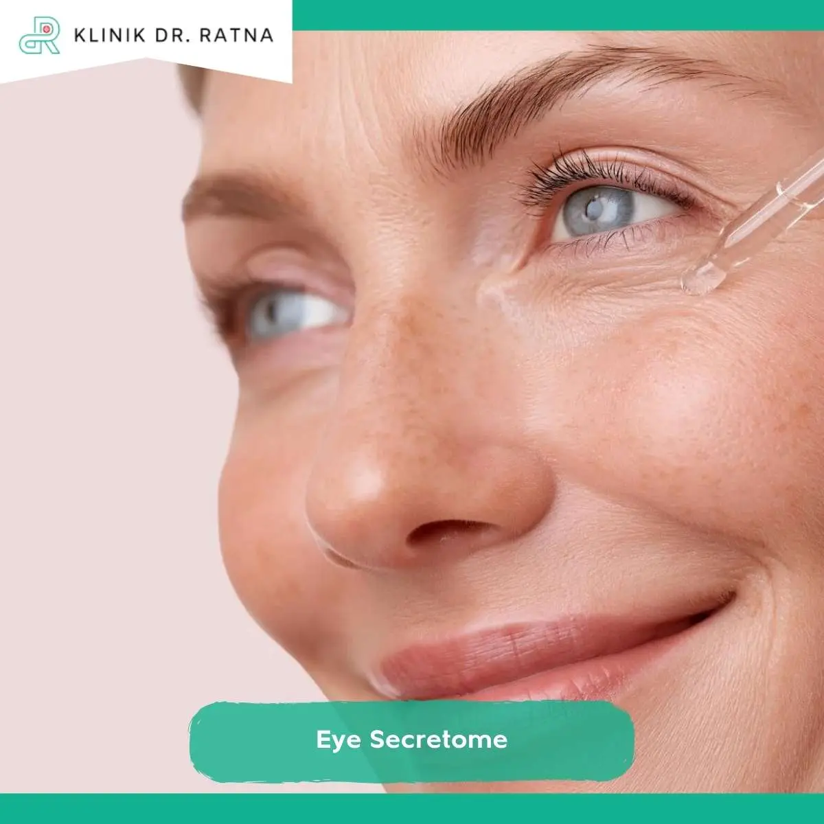 Kenapa Harus Treatment Eye Secretome di Klinik dr Ratna?