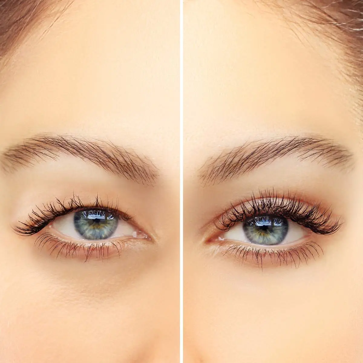 Double Eyelid