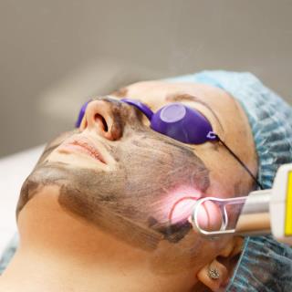 Laser Skin Resurfacing